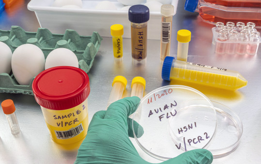 Scientific sampling of eggs in poor condition, analysis of avian influenza in humans, conceptual image